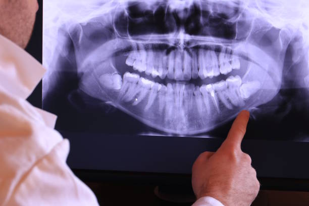 Best Emergency Care for Gum Disease in Amboy, WA