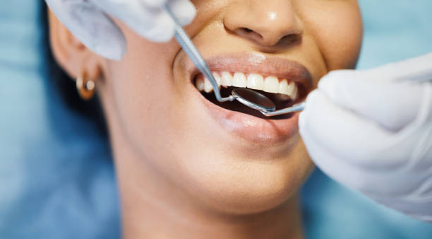 Best Dental Abscess Treatment in Amboy, WA